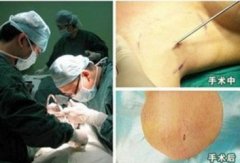 广州肤康皮肤病医院