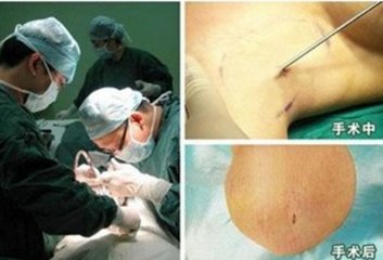 广州肤康皮肤病医院