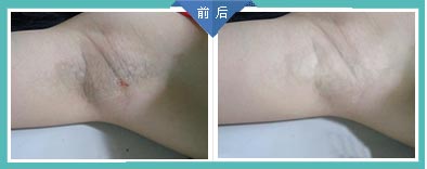 广州肤康皮肤病医院